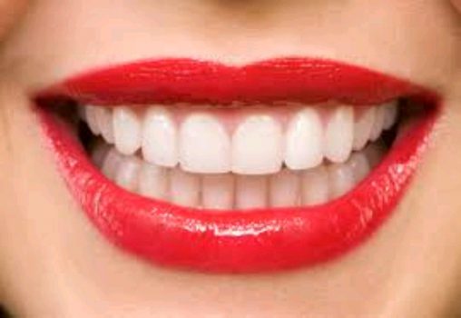 آیا سفید کردن دندان ضرر دارد؟