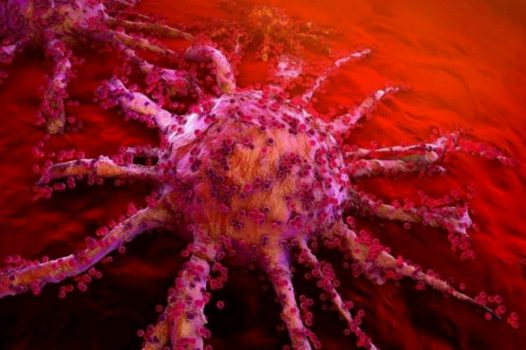 نابودی سرطان با رشد نانوذرات طلا در تومورها