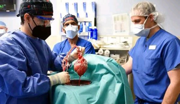 روزی تاریخی در پزشکی؛ نخستین پیوند قلب خوک به انسان انجام شد