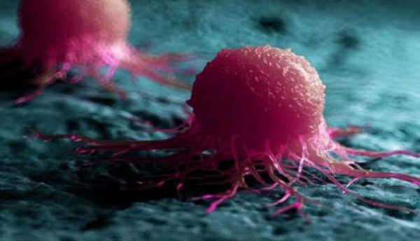 ویروس کشنده سلول های سرطانی یافت شد