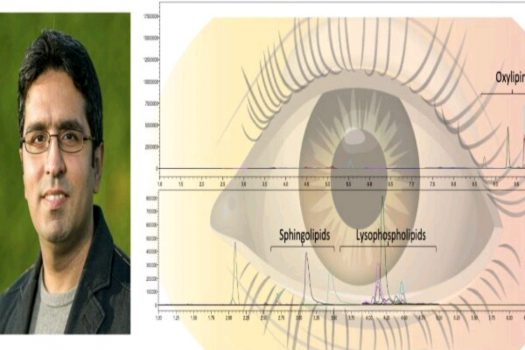 روش ابداعی محقق ایرانی برای تشخیص بیماری های چشمی