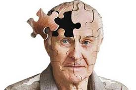 علت بروز بیماری آلزایمر چیست؟ویدئو